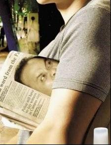 狐臭是什么味道 (改良小切口汗腺清除术)改良小切口汗腺清除术前后对比.gif